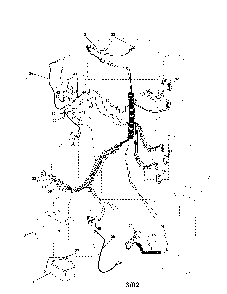 Part Location Diagram of 156417 Poulan Case, Battery