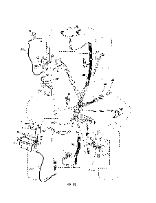 Electrical Diagram and Parts List for 96042001700  Poulan Lawn Tractor